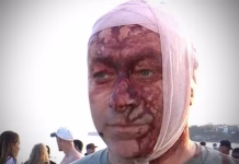 Sobrevivió al ataque terrorista de Hamas del 7 de octubre y años después resultó herido en el atentado en Australia: “Fue una masacre”