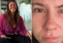 Una joven tiktoker perdió la visión por un parásito en México